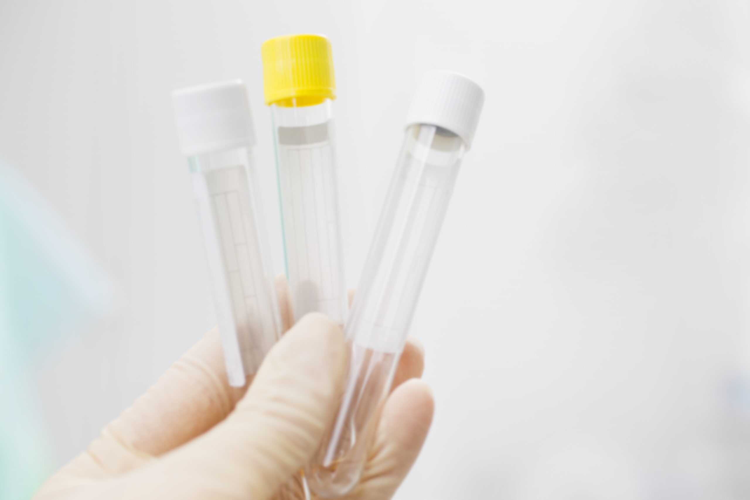 RNase/DNase-free and pyrogens: what quality declarations should sterile tubes have